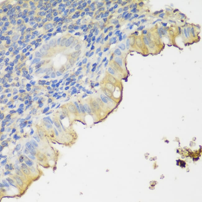 100UL CLN5 ANTIBODY 100 ul