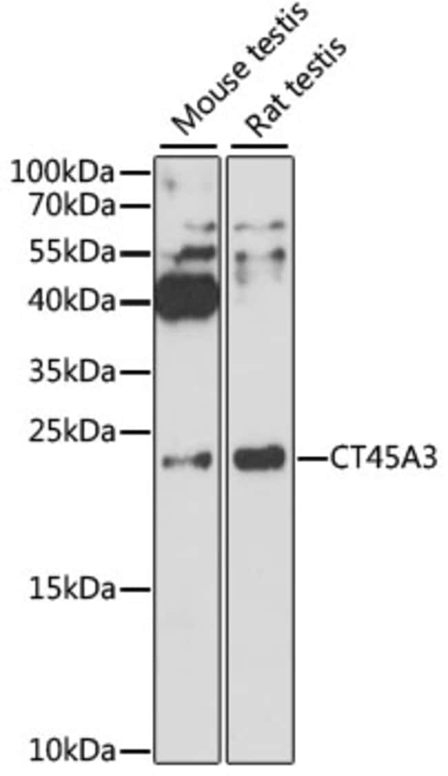 100UL CT45A ANTIBODY 100 ul