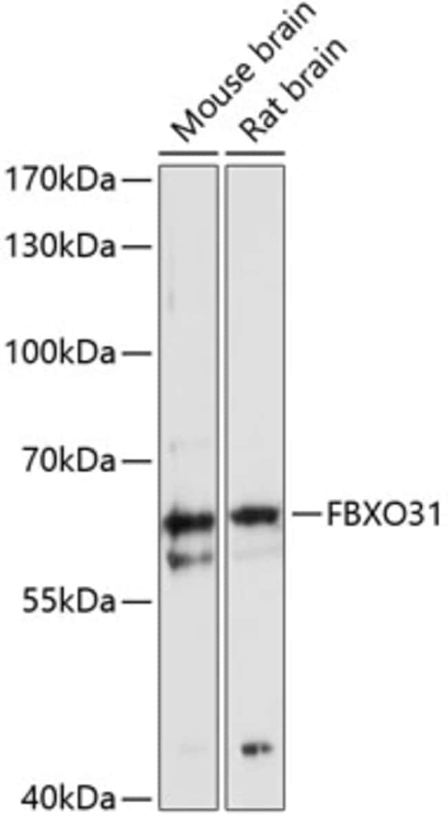 100UL FBXO31 ANTIBODY 100 ul