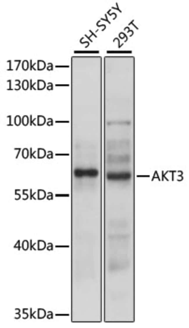100UL AKT3 ANTIBODY 100 ul