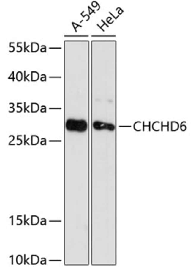100UL CHCHD6 ANTIBODY 100 ul