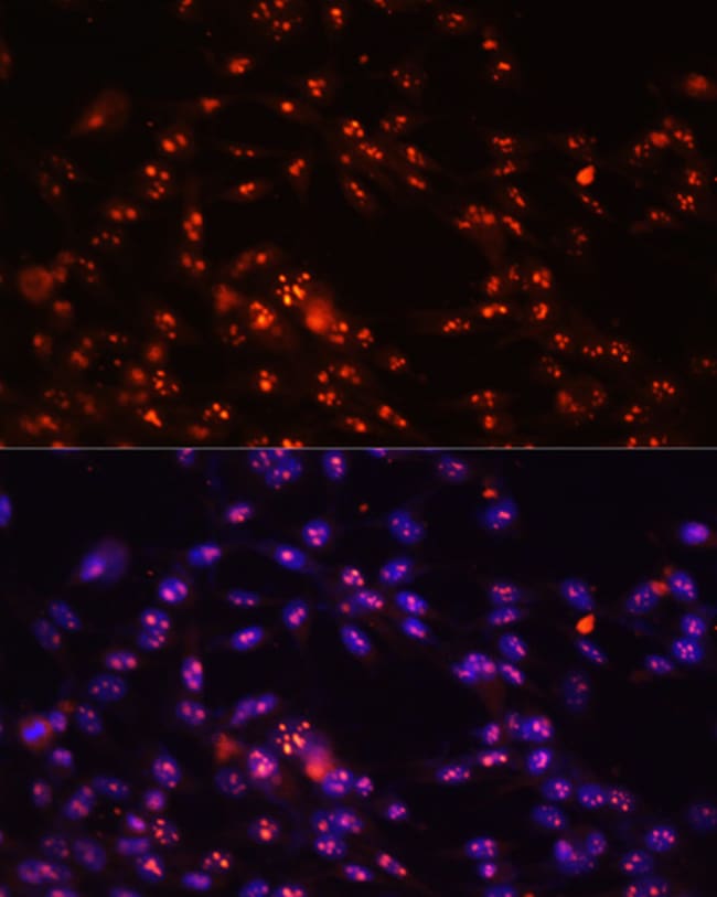 100UL DKC1 ANTIBODY 100 ul