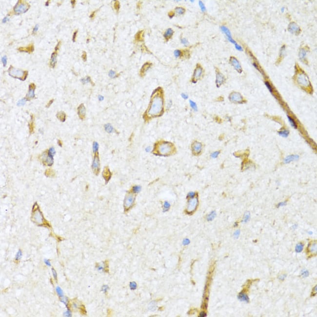 100UL DNAJB11 ANTIBODY 100 ul