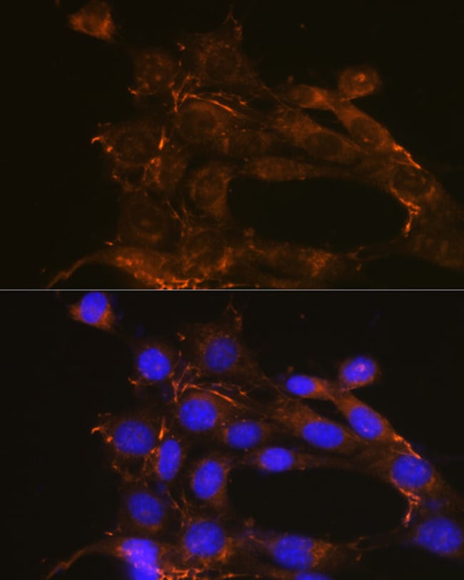 100UL FIBRONECTIN ANTIBODY 100 ul