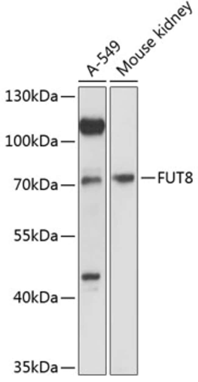 100UL FUT8 ANTIBODY 100 ul