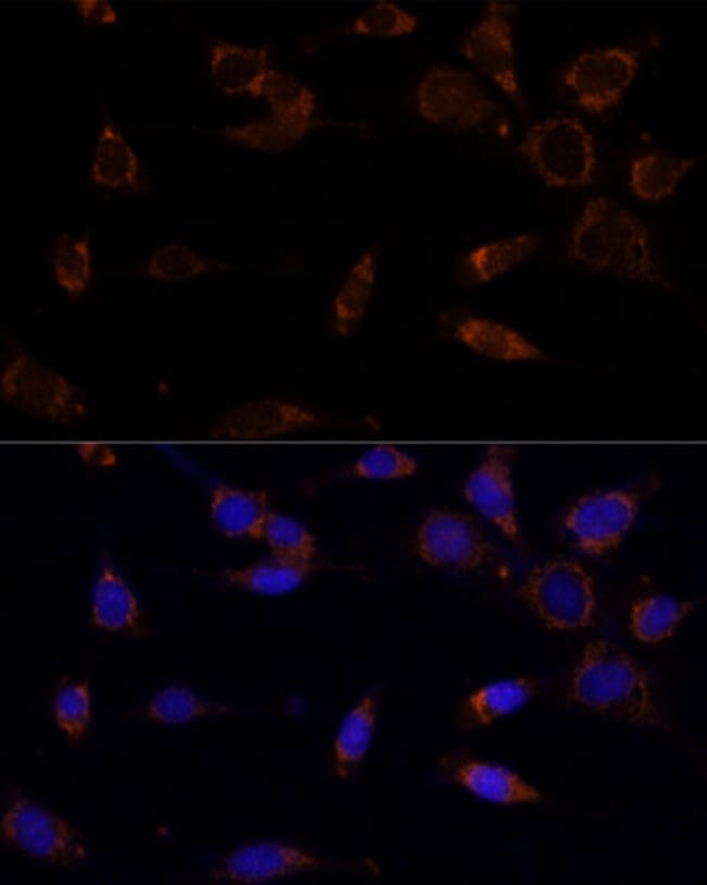 100UL MTCH2 ANTIBODY 100 ul