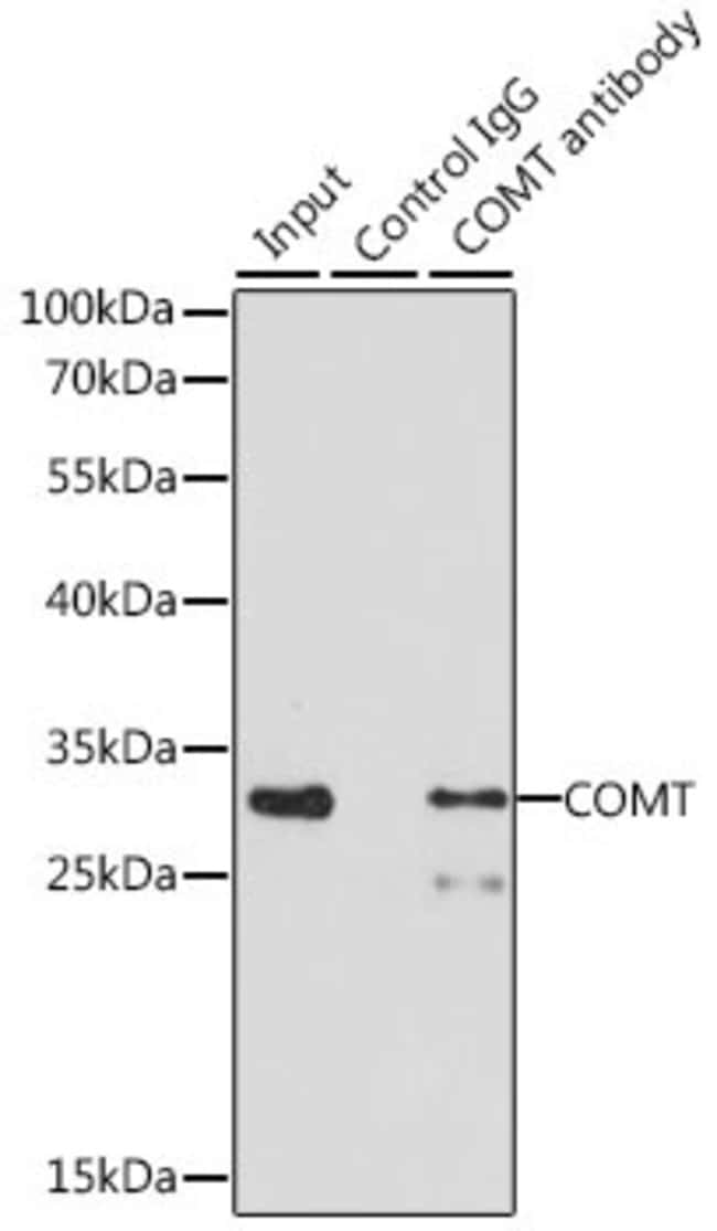100UL COMT ANTIBODY 100 ul