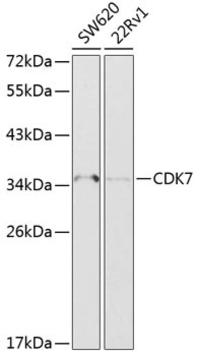 100UL CDK7 ANTIBODY 100 ul