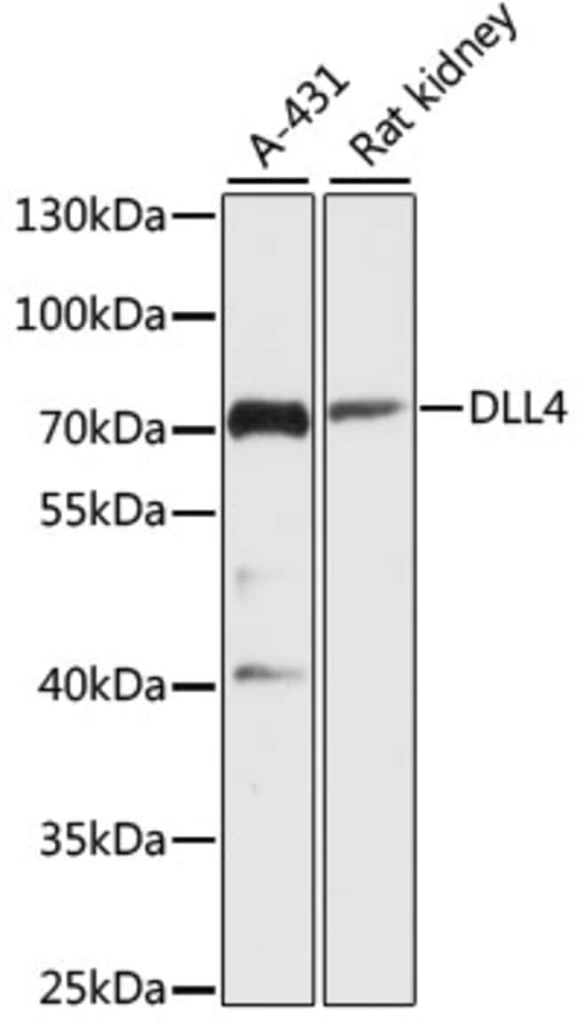 100UL DLL4 ANTIBODY 100 ul