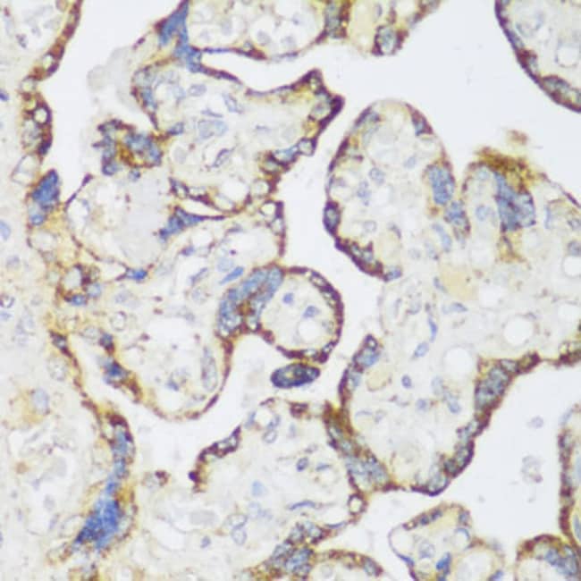 100UL ECH1 ANTIBODY 100 ul