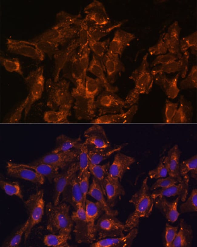 100UL HSD17B8 ANTIBODY 100 ul