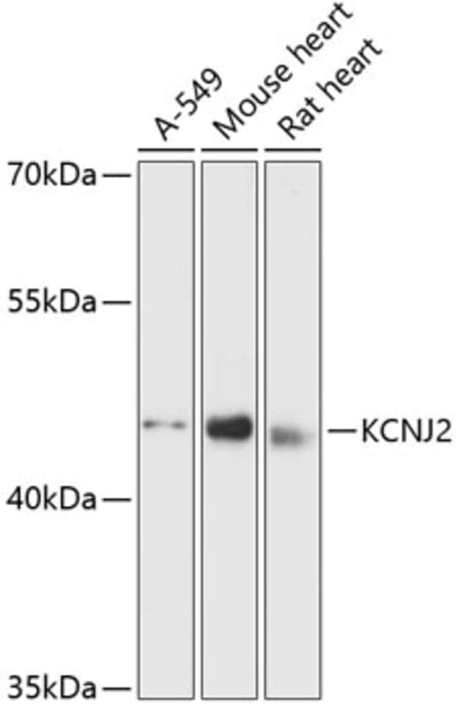 100UL KIR2.1 (KCNJ2) ANTIBODY 100 ul