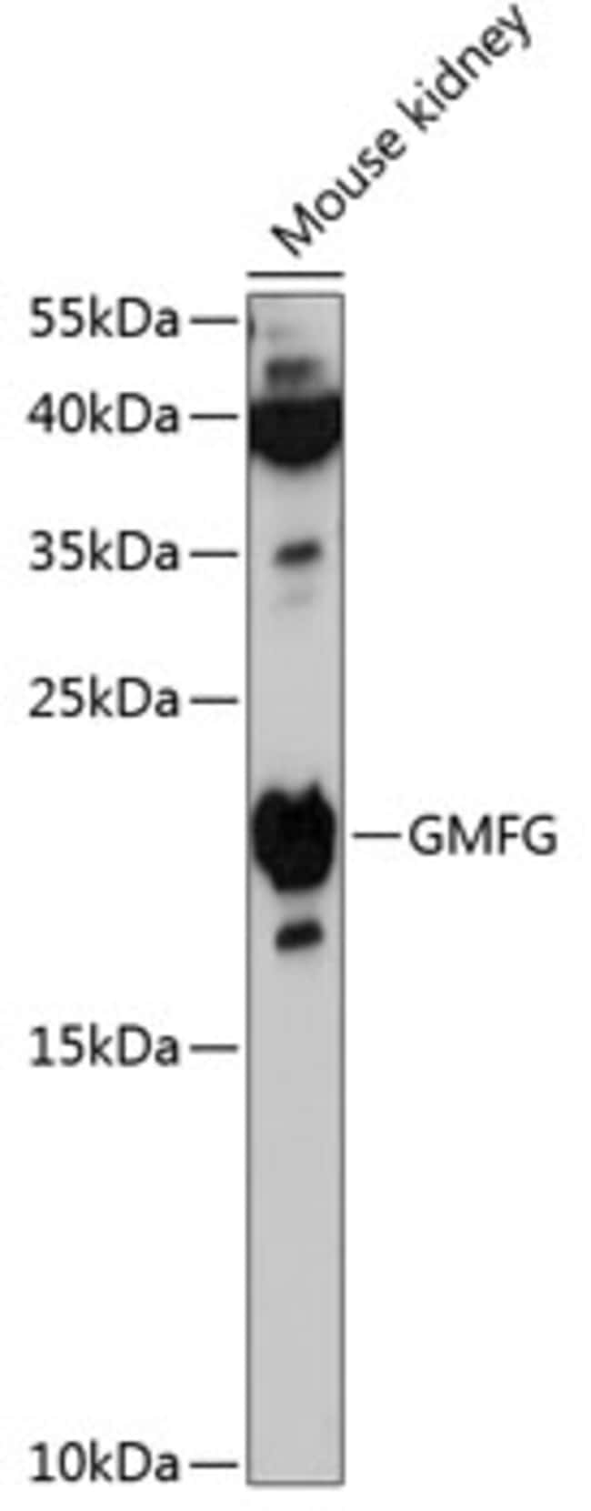 100UL GMFG ANTIBODY 100 ul