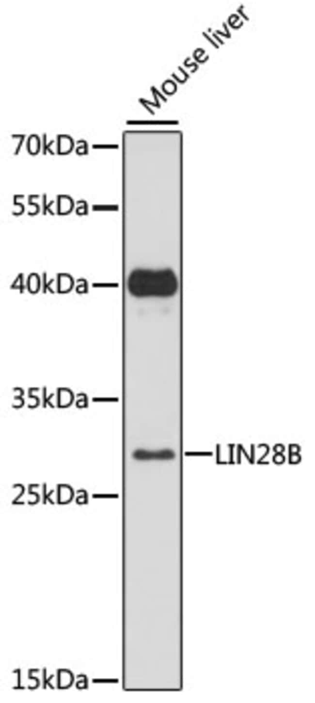100UL LIN28B ANTIBODY 100 ul