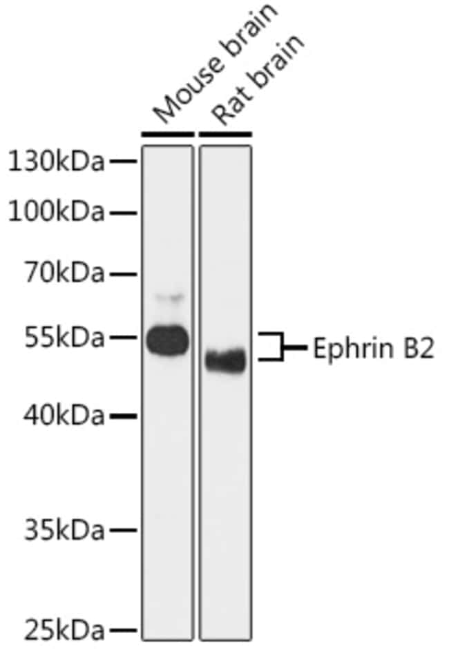 100UL EPHRIN B2 ANTIBODY 100 ul