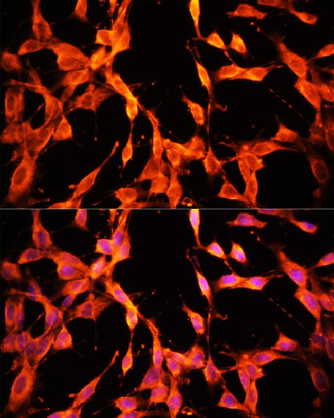 100UL MSP ANTIBODY 100 ul