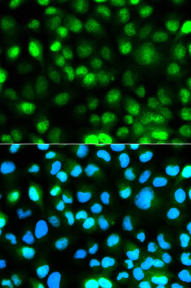 100UL ATAXIN 3 ANTIBODY 100 ul