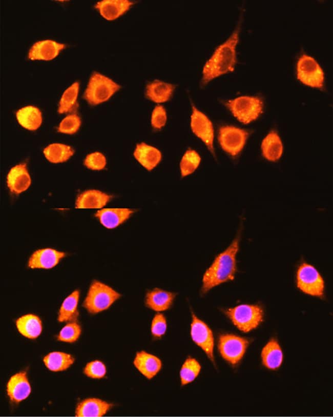 100UL GBP2 ANTIBODY 100 ul
