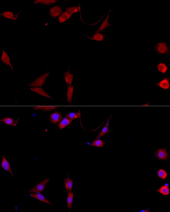 100UL CD154 (CD40 LIGAND) ANTIBODY 100 u