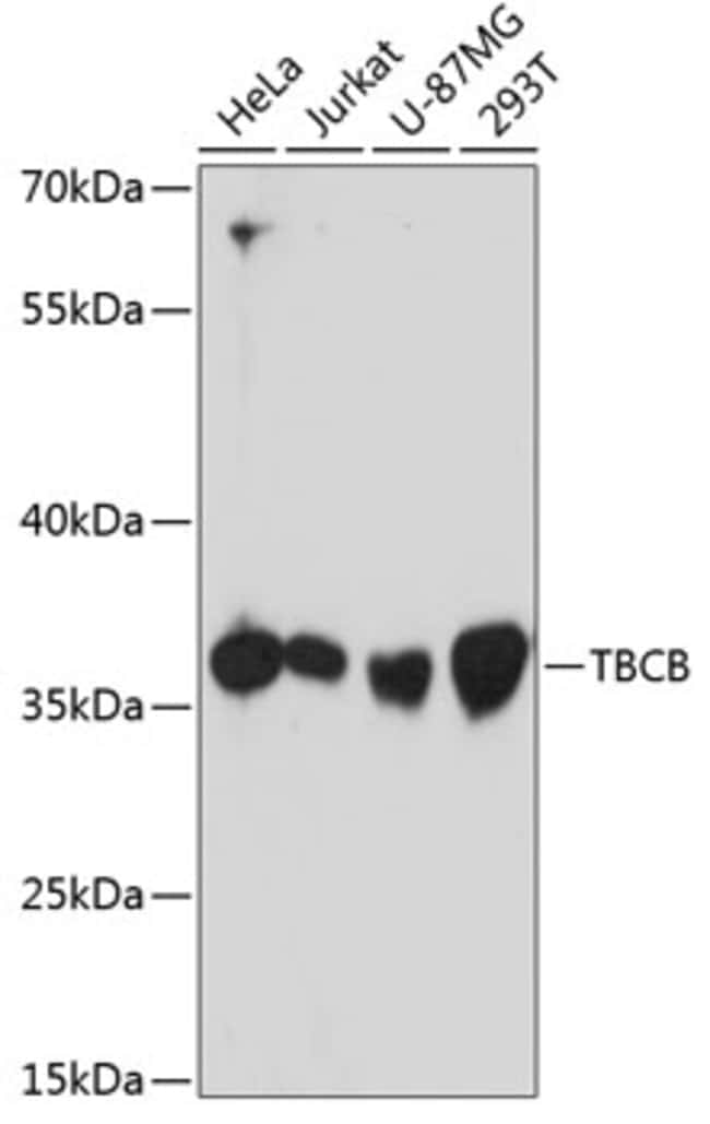 100UL CKAP1 ANTIBODY 100 ul