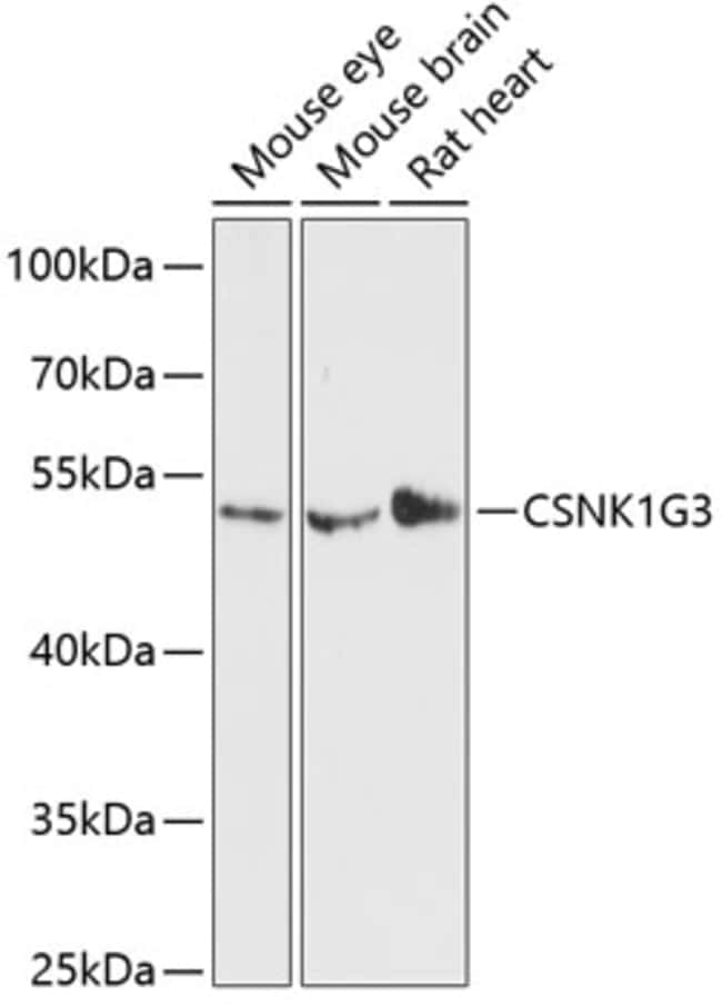 100UL CK1 GAMMA-3 ANTIBODY 100 ul