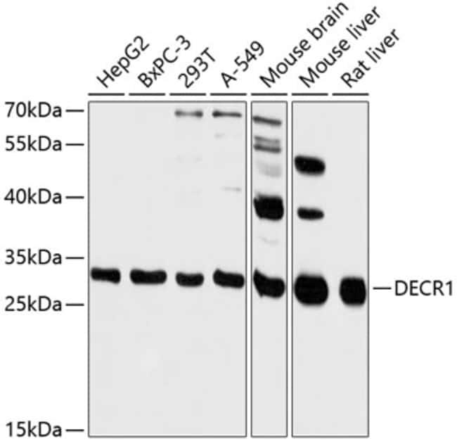 100UL DECR1 ANTIBODY 100 ul