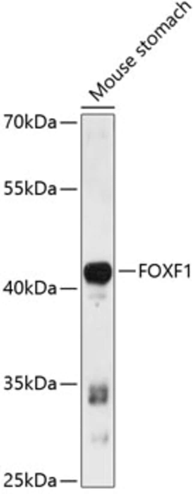 100UL FOXF1 ANTIBODY 100 ul