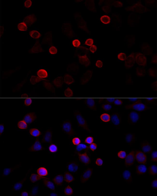 100UL FILAMIN 2 ANTIBODY 100 ul