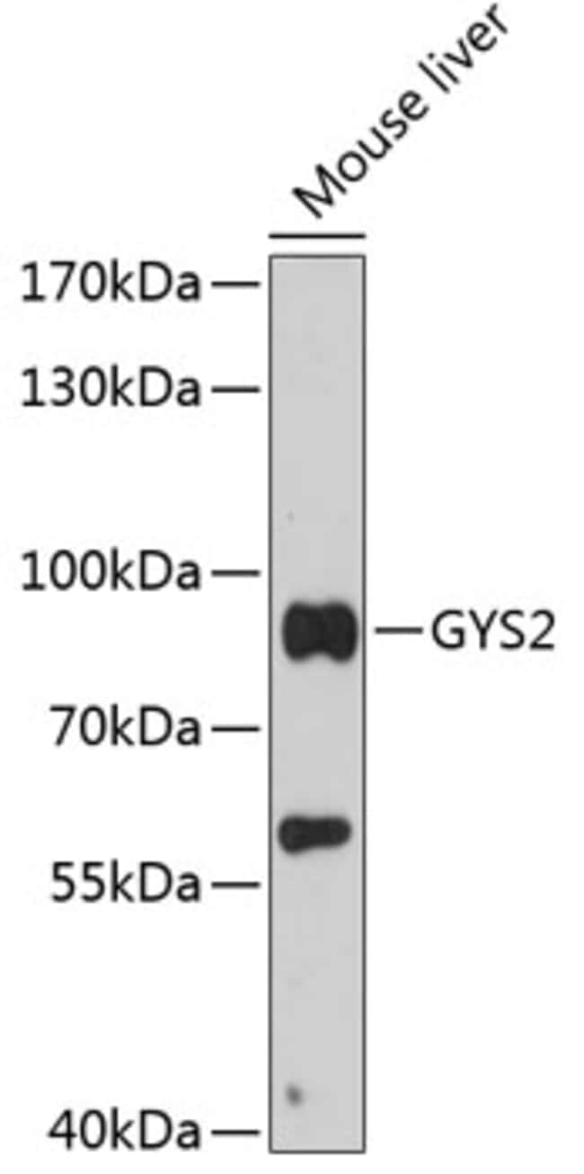 100UL GYS2 ANTIBODY 100 ul