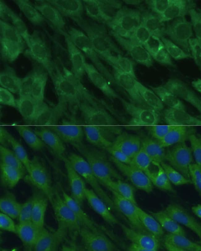 100UL HAL ANTIBODY 100 ul