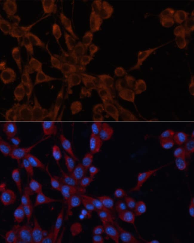 100UL IGF2R ANTIBODY 100 ul