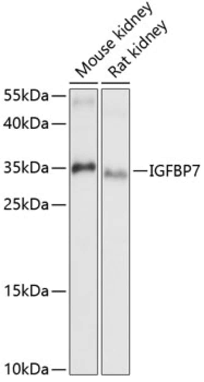 100UL IGFBP7 ANTIBODY 100 ul
