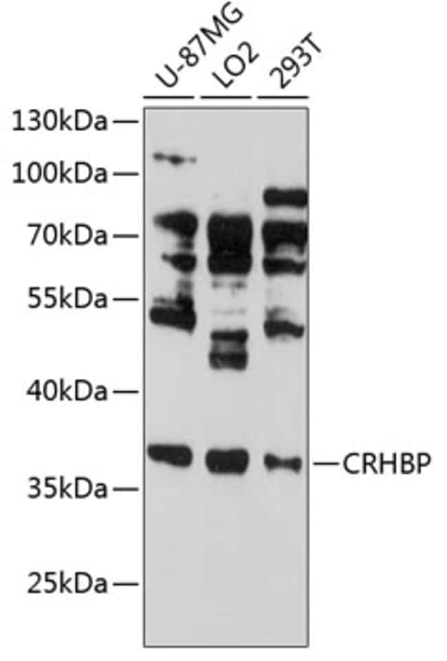 100UL CRHBP ANTIBODY 100 ul