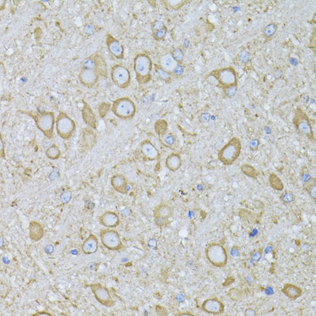 100UL MTNR1A ANTIBODY 100 ul