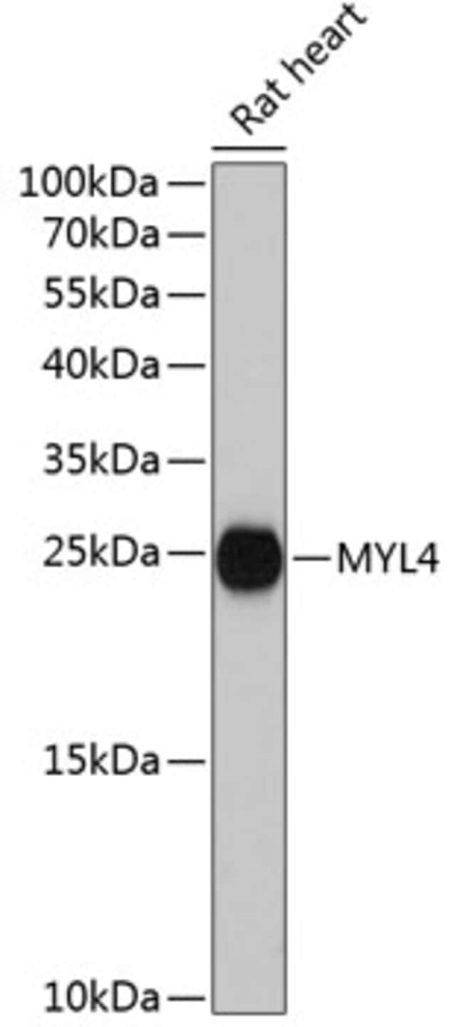 100UL MYL4 ANTIBODY 100 ul