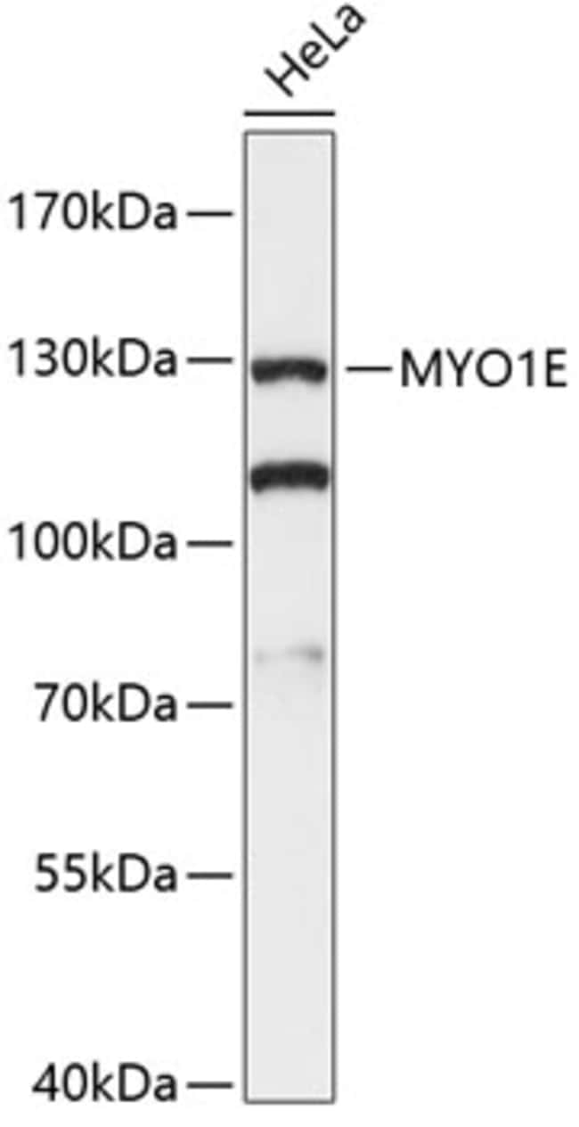 100UL MYO1E ANTIBODY 100 ul