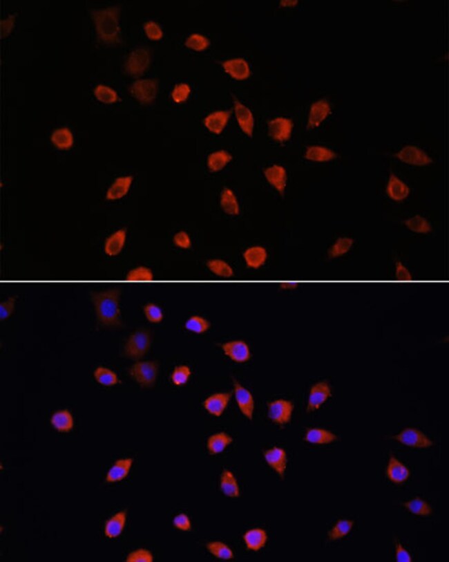 100UL IFT88 ANTIBODY 100 ul