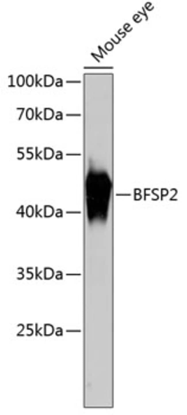 100UL BFSP2 ANTIBODY 100 ul