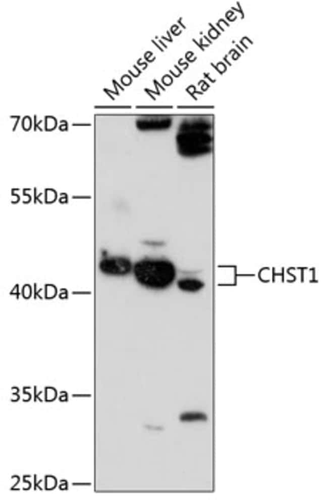 100UL CHST1 ANTIBODY 100 ul