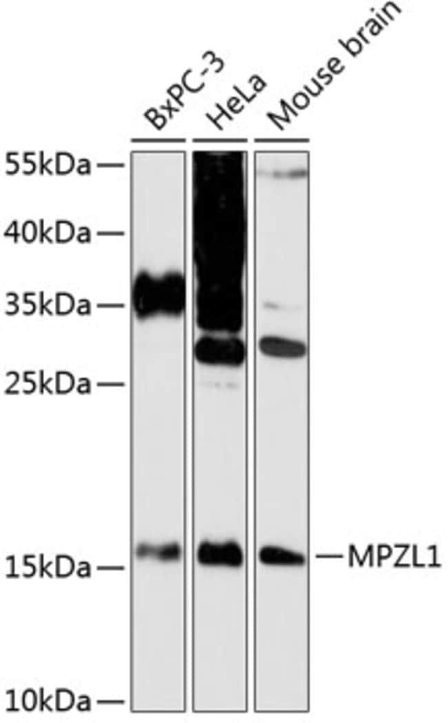 100UL MPZL1 ANTIBODY 100 ul
