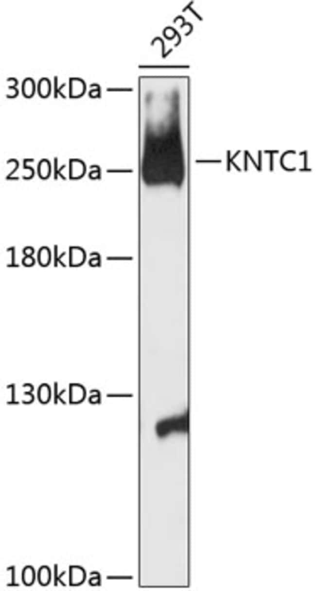 100UL KNTC1 ANTIBODY 100 ul