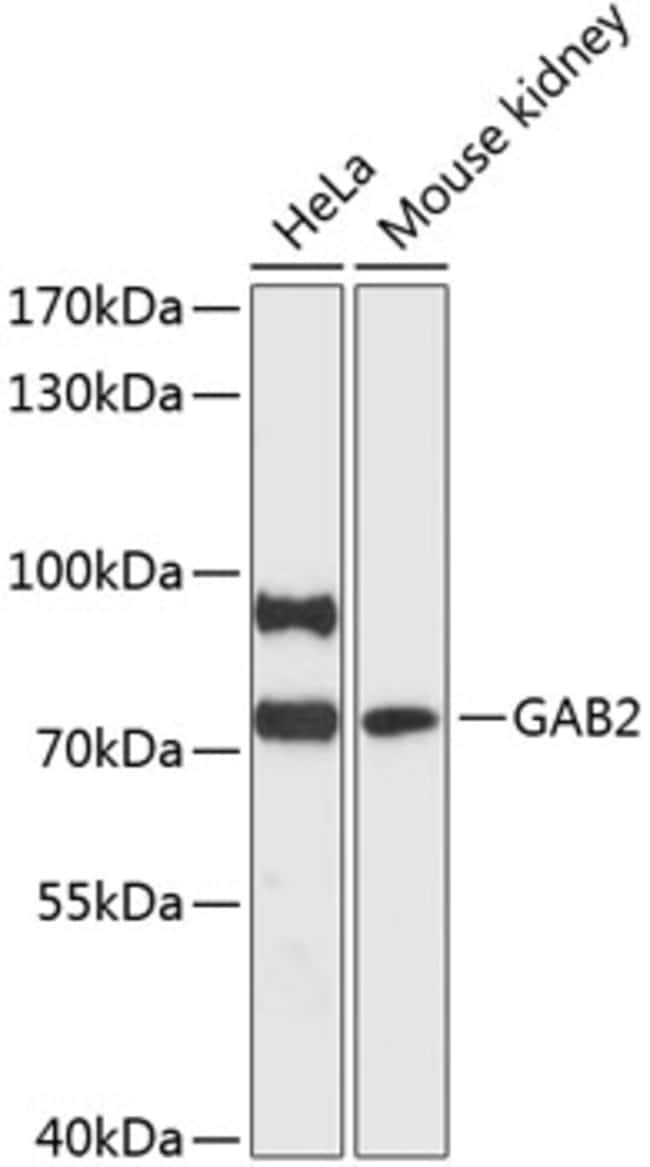 100UL GAB2 ANTIBODY 100 ul