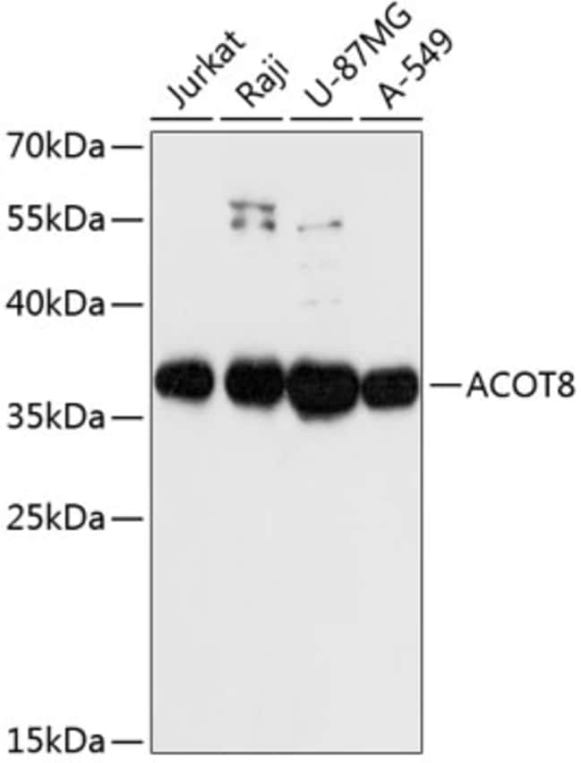 100UL ACOT8 ANTIBODY 100 ul