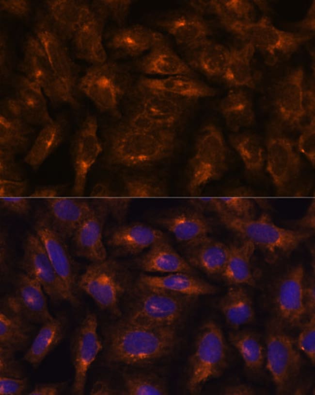 100UL IFITM3 ANTIBODY 100 ul
