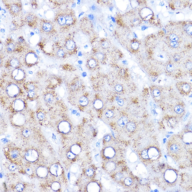 100UL AADAT ANTIBODY 100 ul
