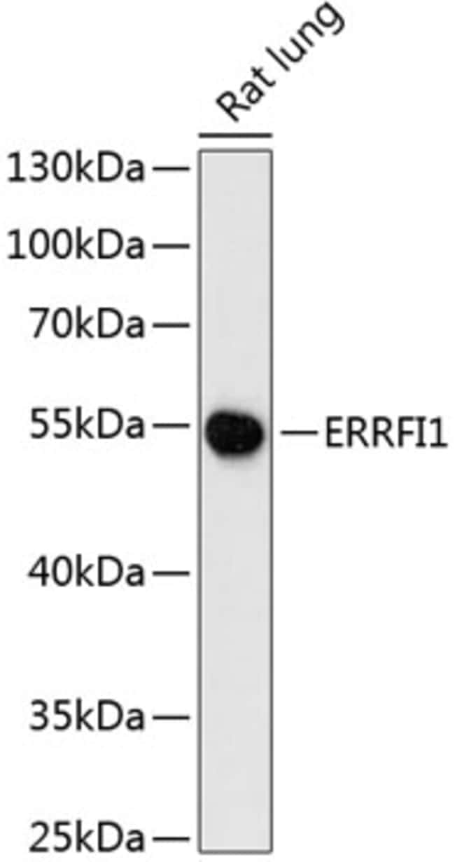 100UL MIG-6 ANTIBODY 100 ul