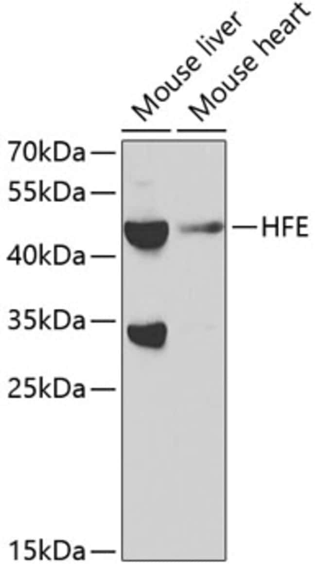 100UL HFE ANTIBODY 100 ul