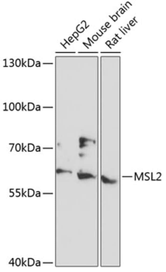 100UL MSL2 ANTIBODY 100 ul
