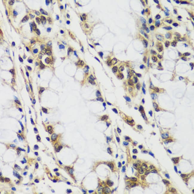 100UL CASC5 ANTIBODY 100 ul