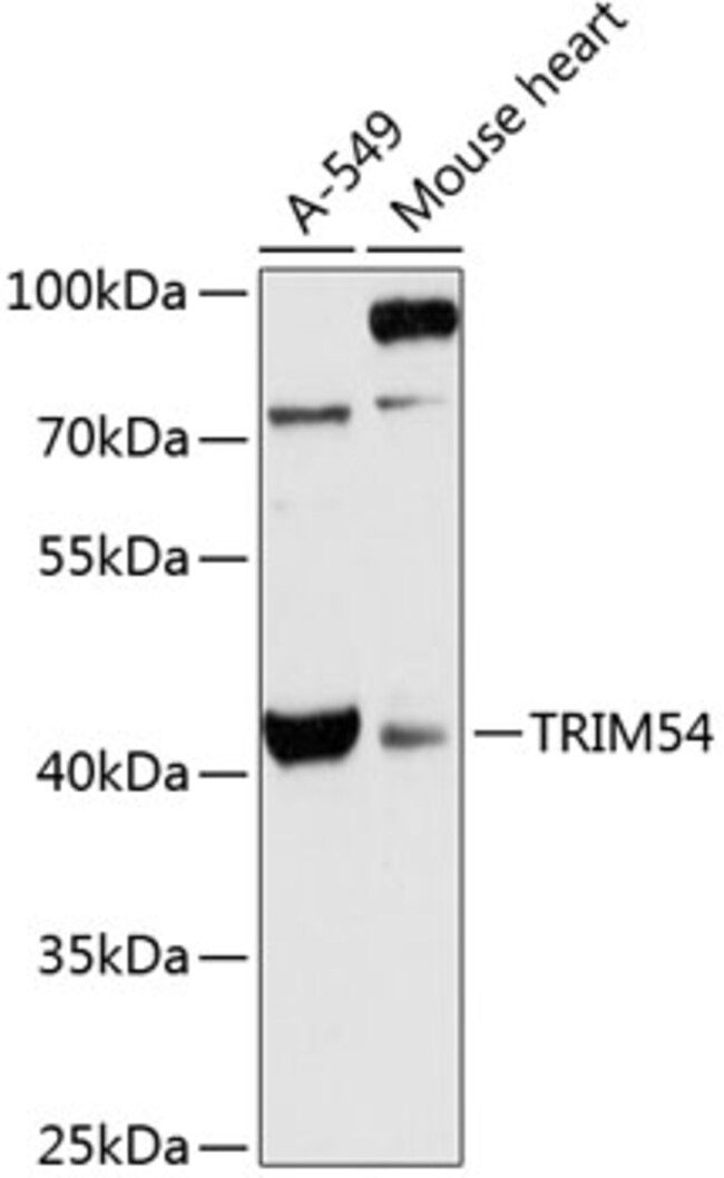 100UL MURF3 ANTIBODY 100 ul